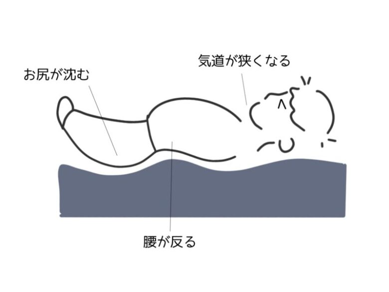 肥満が及ぼす睡眠時への影響