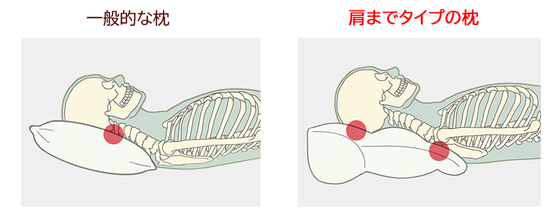 枕は肩まで １０年整骨院経営の私がおすすめ枕を厳選 ゆう接骨院